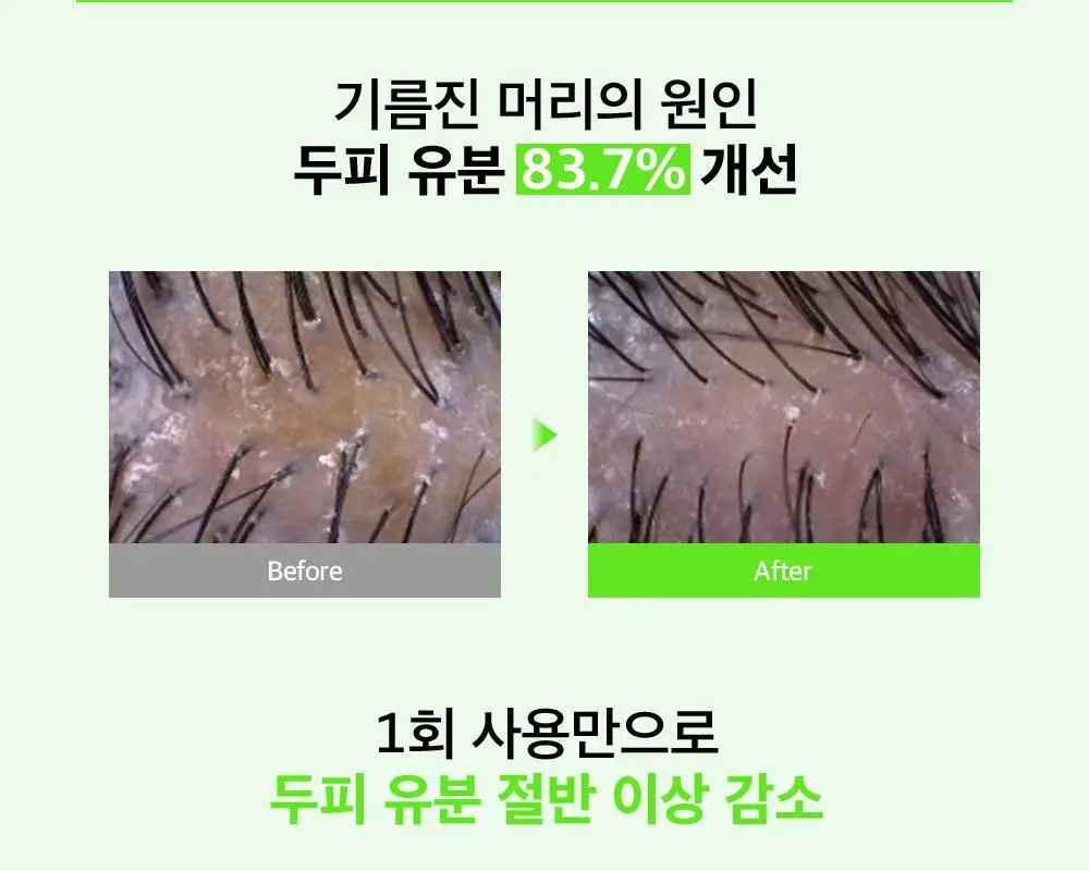 [대용량] 더마비 프레쉬 스칼프 클리어 샴푸 1000ml 2종 택 1 (베르가못그린/플로럴그린) 상세페이지 13